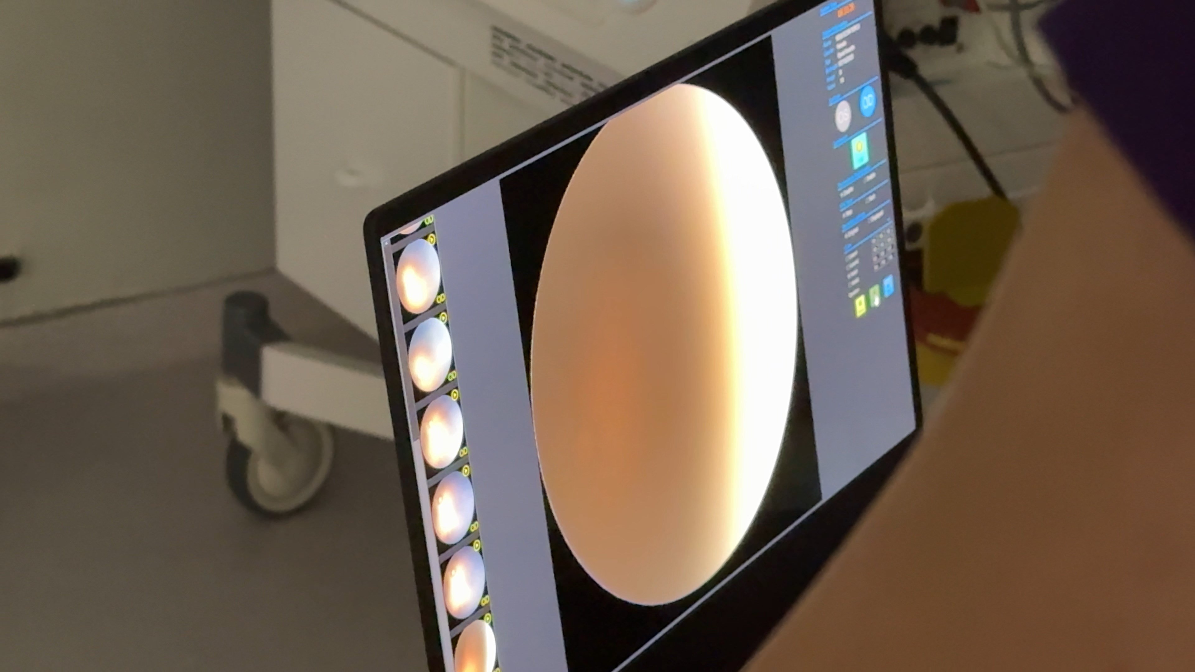 Rize’de Prematüre Bebeklerde Görme Kaybı Tarihe Karışıyor!